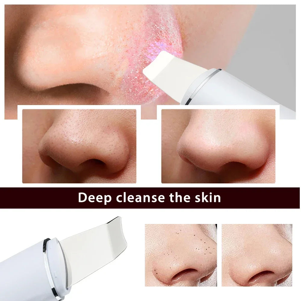 Ultrasonic Skin Scrubber Electric Facial Cleansing Pore Deep Cleanser Acne Blackhead Remover Peeling Shovel Lifting Skin Care Peaceful Pleasures Health and Wellness