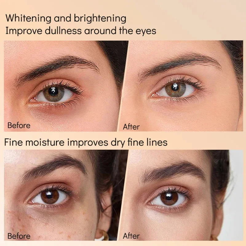 SADOER Retinol Rolling Bead Eye Serum – Firm & Brighten