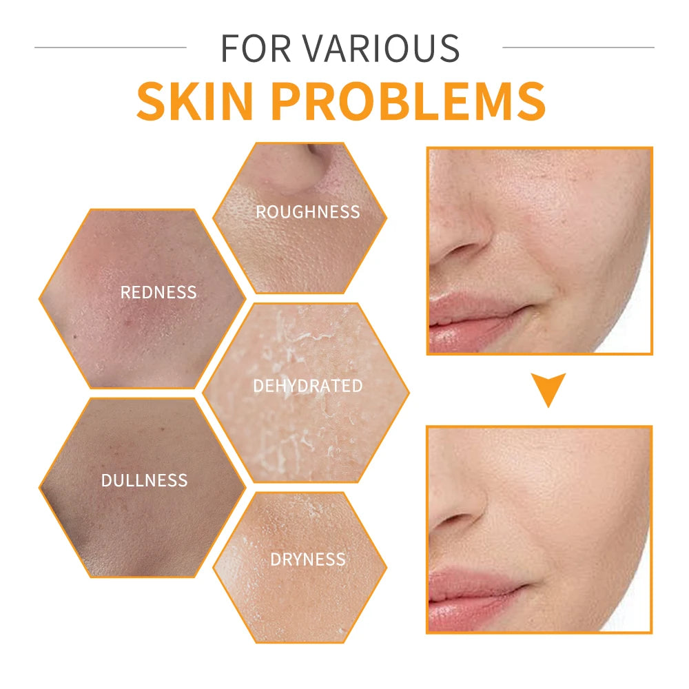 Lakerain Vitamin C Skin Care Set Whitening Cream Dark Spots Serum Dark Circle Eye Facial Cleaning Moisturizing Sunscreen Kits Peaceful Pleasures Health and Wellness