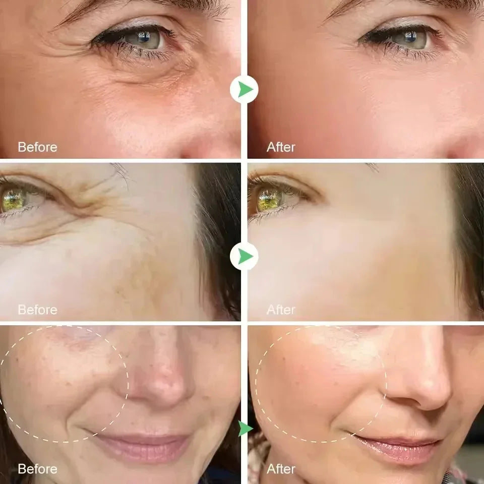 Facial Retinol Serum Whitening Moisturising Fade Fine Lines Anti Wrinkle Anti Ageing Rejuvenate Your Face Korean Cosmetics 30ml Peaceful Pleasures Health and Wellness