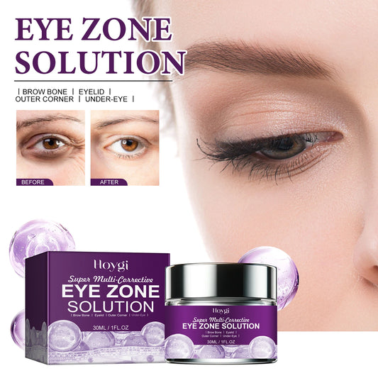 Hoygi Eye Cream – Dark Circles, Bags & Wrinkles 30ml Eye Cream Peaceful Pleasures Health and Wellness
