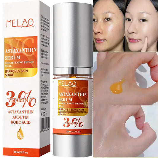 VC Astaxanthin Whitening Serum Remove Dark Spots Freckles Fade Melanin Anti-Wrinkle Brightening Nourishing Face Skin Care Peaceful Pleasures Health and Wellness