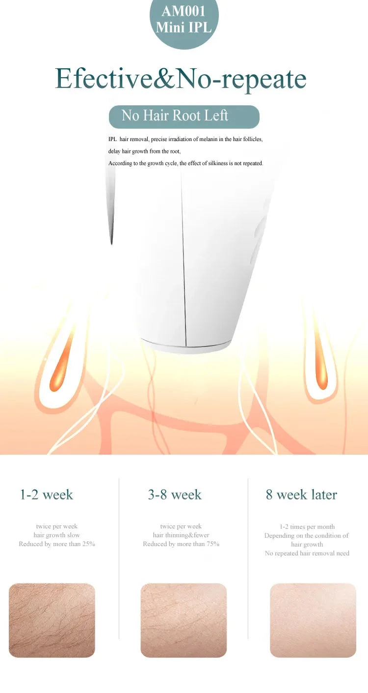 IPL Hair Removal Device – Permanent, Whole Body Peaceful Pleasures Health and Wellness