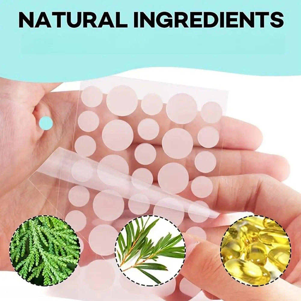 Hydrocolloid Acne Pimple Patches with Tea Tree Oil – 360-400ct