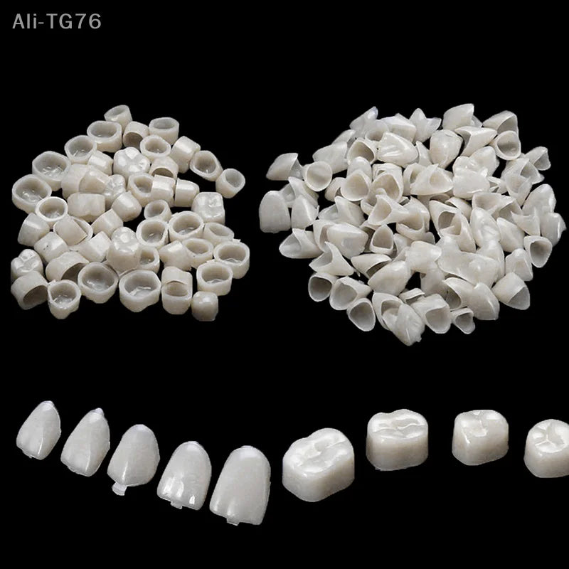 Dental Temporary Crown Kit – 100 Pcs Anterior & Molar Veneers