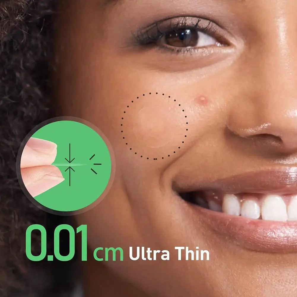 Microneedle Acne Patch Waterproof Concealer Tool Peaceful Pleasures Health and Wellness