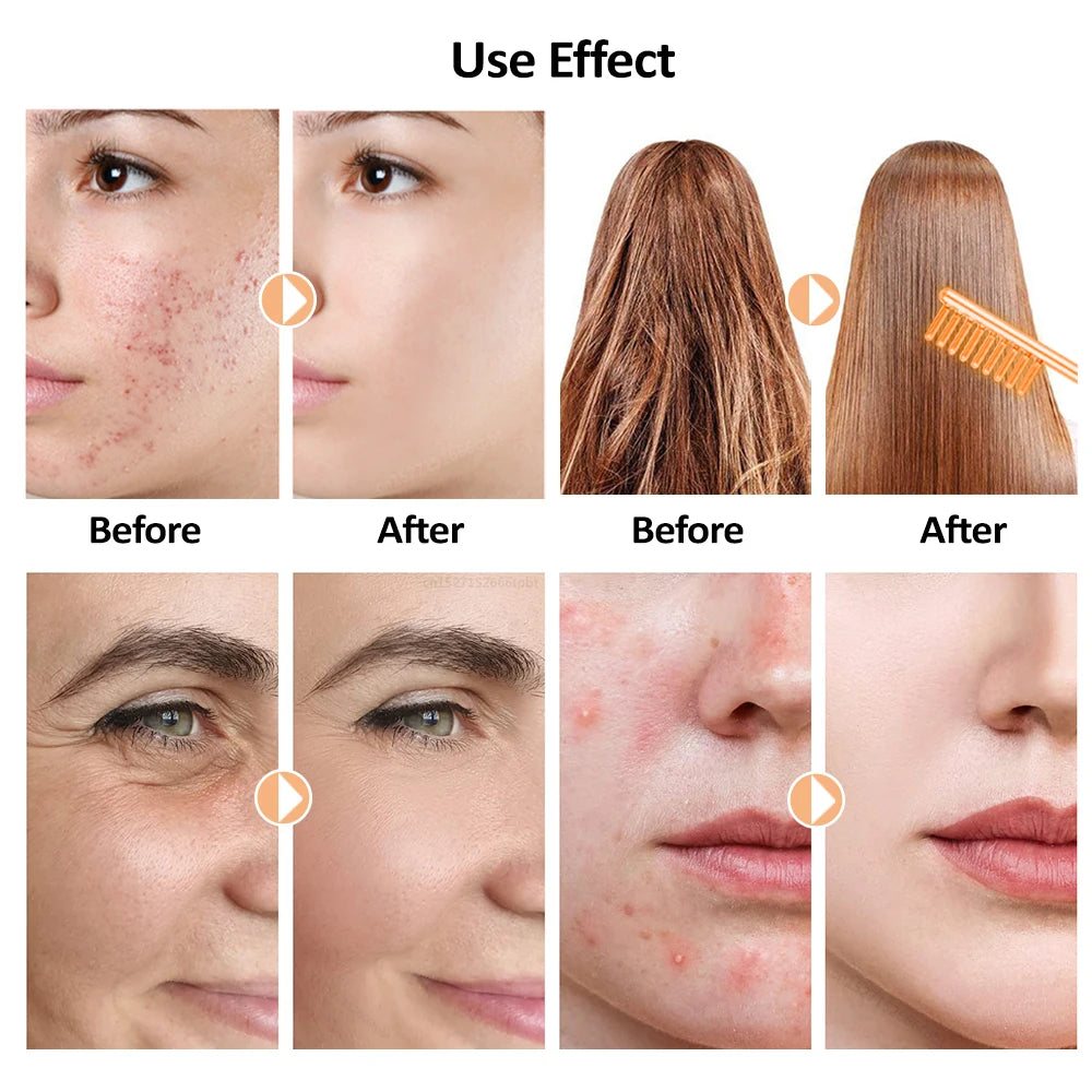 Electrotherapy Wand High Frequency Electrode Glass Tube Wand for Face Skin Tightening Machine Facial Acne Spot Wrinkles Remover Peaceful Pleasures Health and Wellness