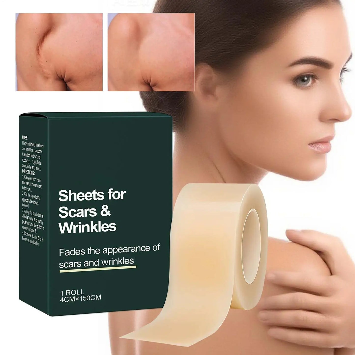 Silicone Scar Sheet Roll 4cm×150cm – Cuttable Skin Care Strip