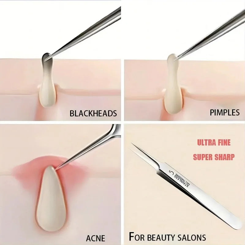No. 5 Extra Fine Blackhead Removal Tweezers | Skincare Tool Blackhead Removal Tool Peaceful Pleasures Health and Wellness