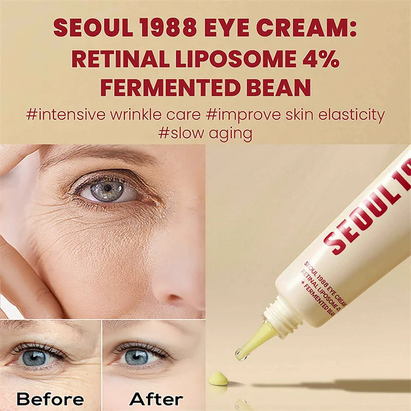 SEOUL 1988 4% Retinol Eye Cream – Firming & Brightening 30ml
