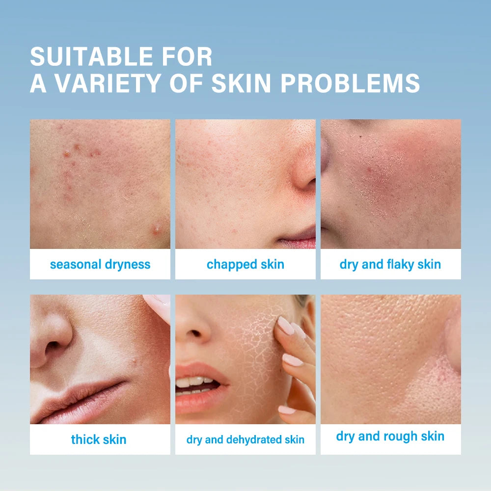 Super Hydrating Cream Moisturizing Facial Skin Dry Long-lasting Moisturizing Restoring Skin Barrier Suitable For All Skin Creams Peaceful Pleasures Health and Wellness
