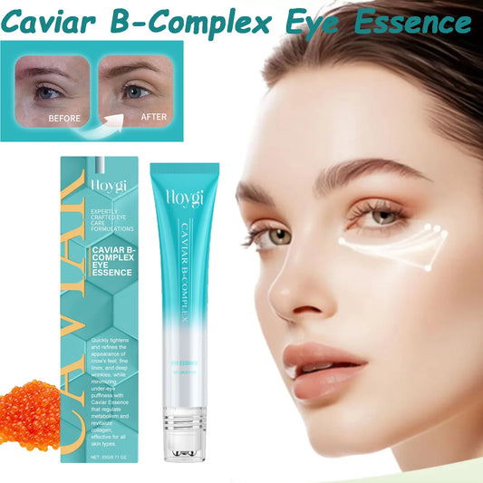 Hoygi Caviar Eye Serum – Dark Circles, Puffiness & Fine Lines Eye Serum Oasis Select