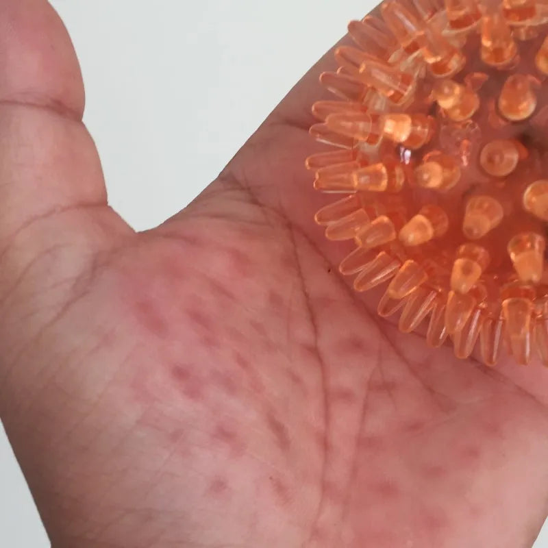 Spiky Ball Hollow Soft Transparent Strength Recovery Exercise Stress Relief Massage Ball for Hand Wrist Peaceful Pleasures Health and Wellness