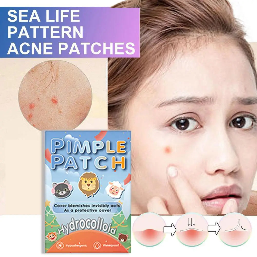 Cartoon Hydrocolloid Acne Patches – 600pc Invisible Blemish Stickers Hydrocolloid Acne Patch Peaceful Pleasures Health and Wellness