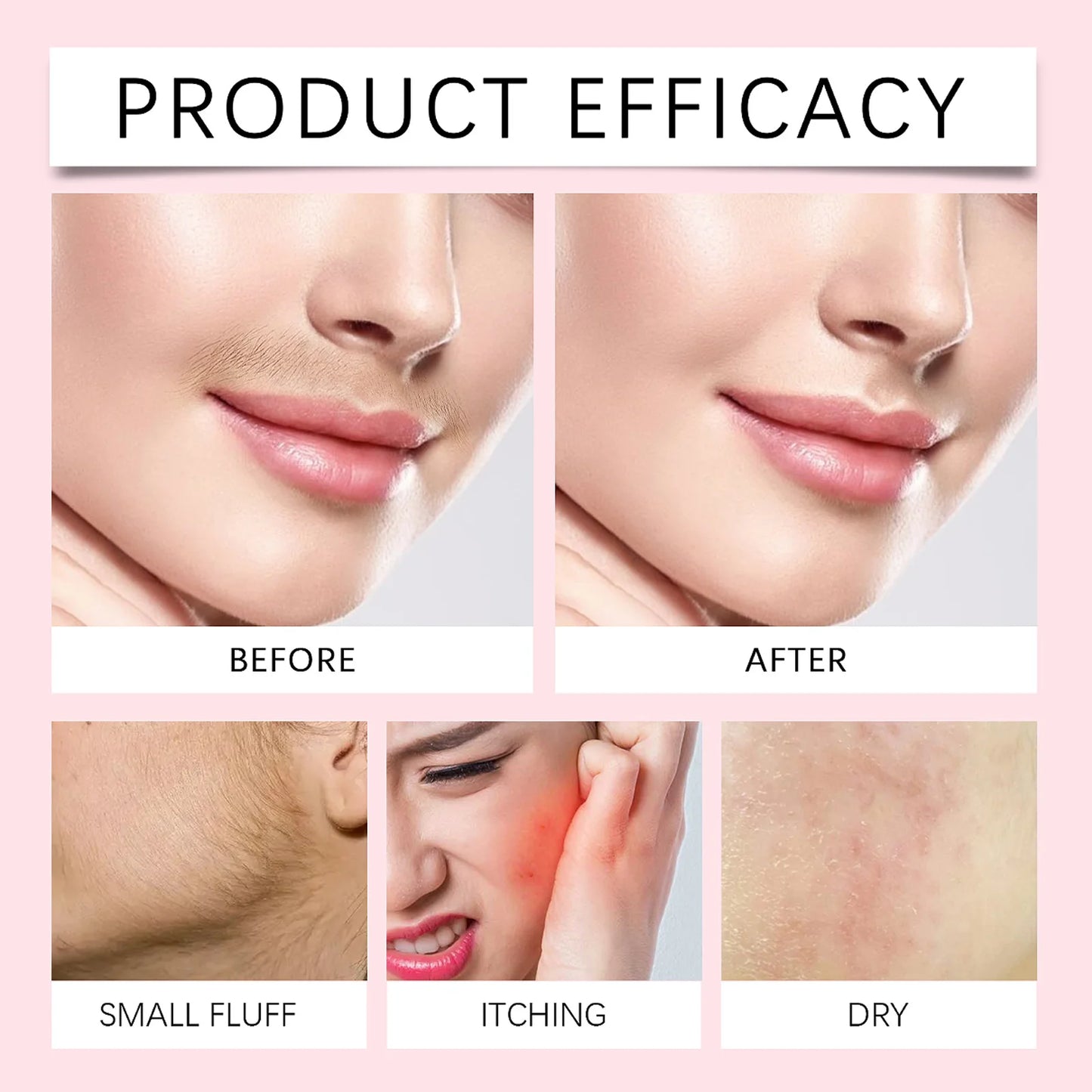 Facial Hair Removal Kit for Women – Gentle Lip & Chin Cream