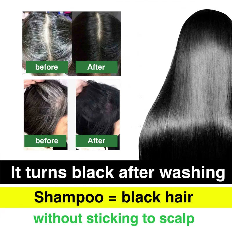 DR.DAVEY Boxed 25ml × 10 PCS Black Hair Dye Nourishes Hair, Cleanses and Cares for It, and Is a Coloring Hair Care Shampoo Peaceful Pleasures Health and Wellness