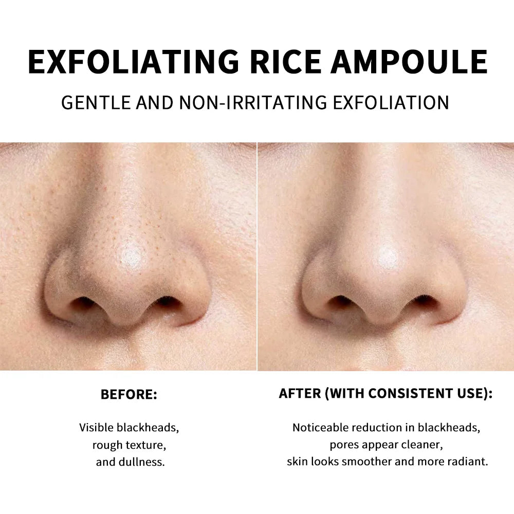 Gentle Rice Exfoliation Brightened-Looking Effect Long-lasting Hydrating Gentle Cleaning Soothing Skin Exfoliant Rice Ampoule Peaceful Pleasures Health and Wellness