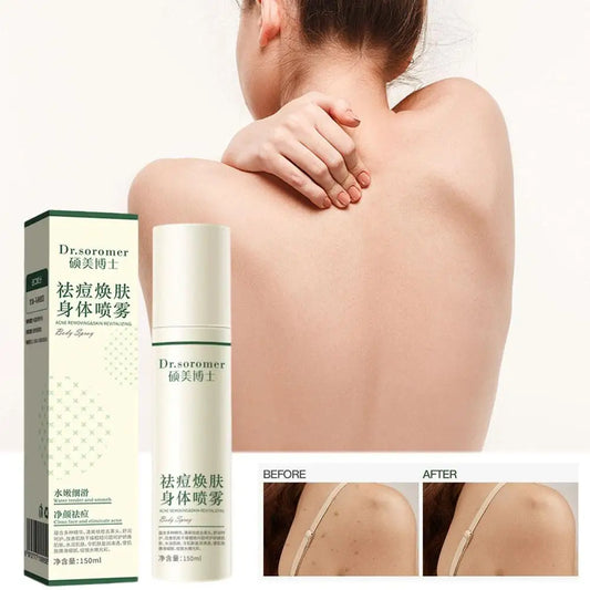 Back Acne Removing Skin Revitalizing Body Spray Shrink Pores Oil Control for Clear Smooth Bright Healthy Skin Care Peaceful Pleasures Health and Wellness