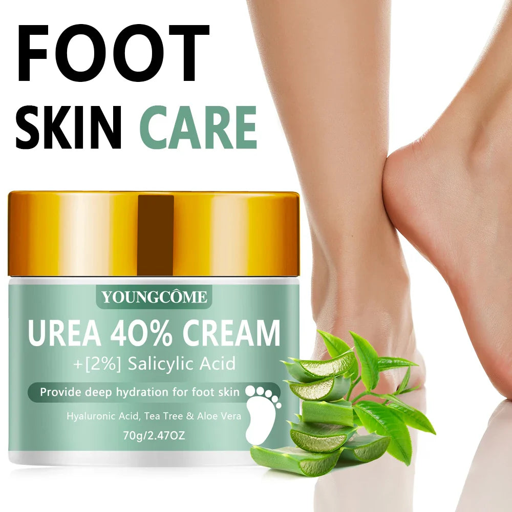 Urea 40% Foot & Hand Cream – Callus Softener | YOUNGCOME
