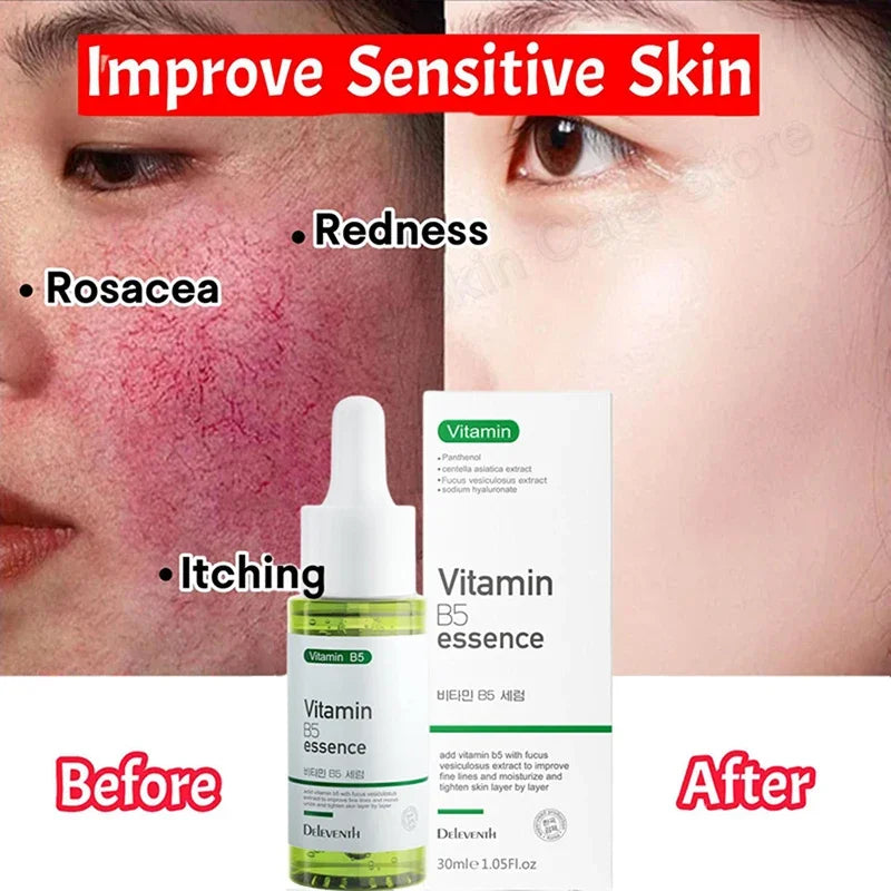 Facial Redness Repair Serum | Sensitive Skin & Rosacea, 30ml