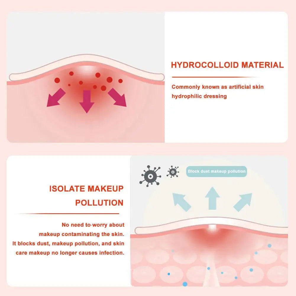 Jaysuing 600-Count Colorful Star Hydrocolloid Acne Patches – Large 12x9cm Sheet, Cute Star-Shaped Invisible Zit Cover Stickers Peaceful Pleasures Health and Wellness