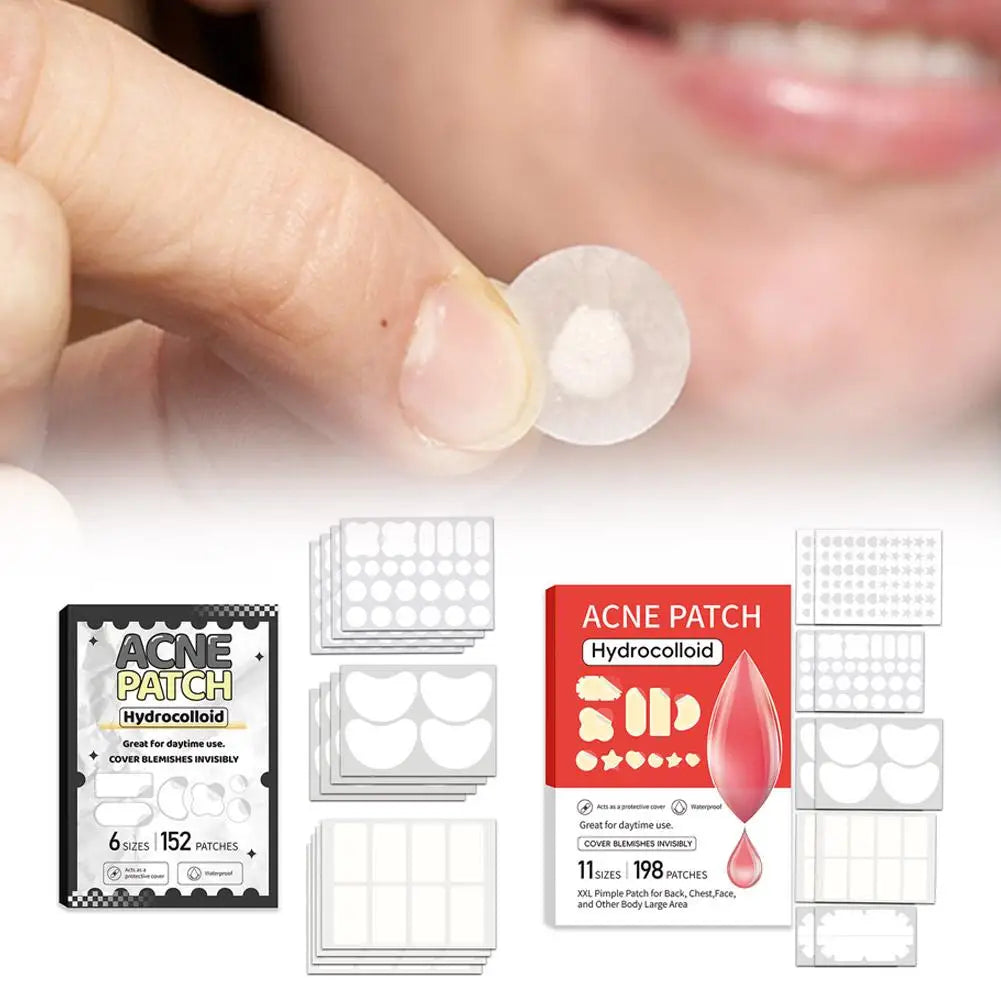 Hydrocolloid Acne Patches – Multi-Shape Invisible Blemish Dots