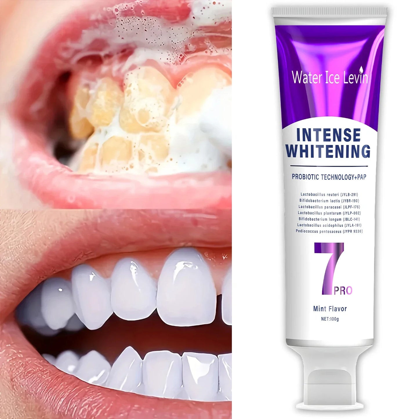 Probiotic Whitening Toothpaste – Fresh Breath & Gum Care