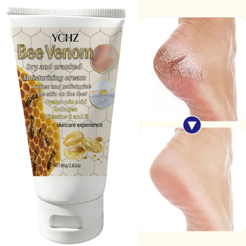 YCHZ Bee Venom Moisturizing Hand & Foot Cream 80g