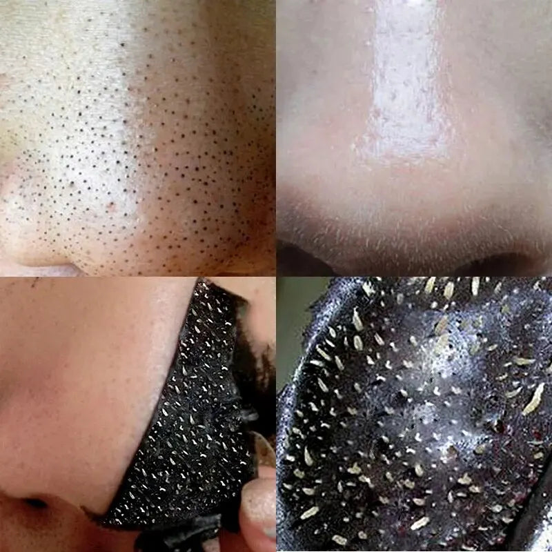 Black Removal Mask Removes nose lines Deep shrink clean pores Nose Black Removal sticker Skin care mask patch Peaceful Pleasures Health and Wellness