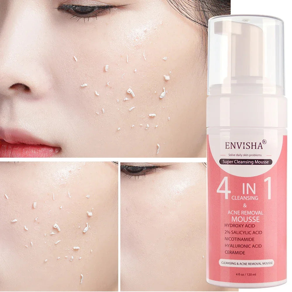 ENVISHA Exfoliating Mousse Peeling Gel – Deep Cleanse & Pore Refining 120ml Face Cleanser Peaceful Pleasures Health and Wellness
