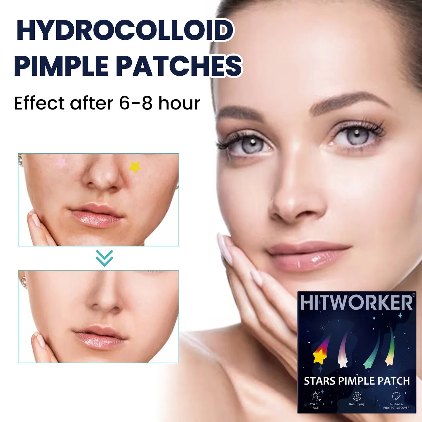 Waterproof Hydrocolloid Acne Patches – Invisible 2-in-1 Skin Care