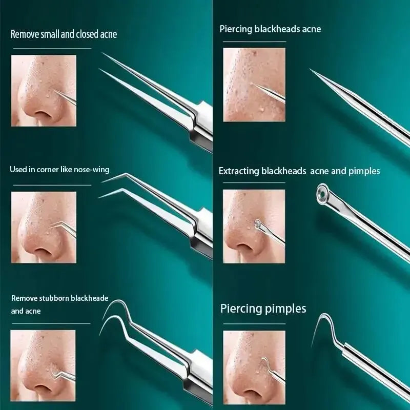 11-Piece Blackhead & Ingrown Hair Removal Skin Care Tool Set