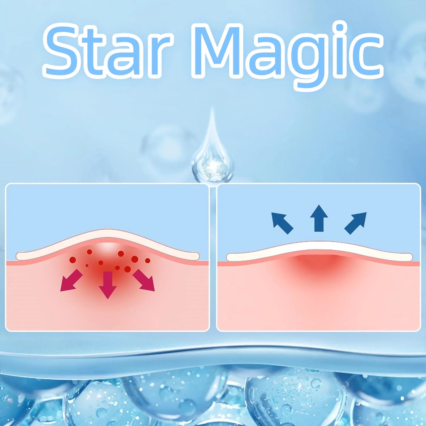 Hydrocolloid Acne Patches – Invisible, Waterproof, All Skin Types