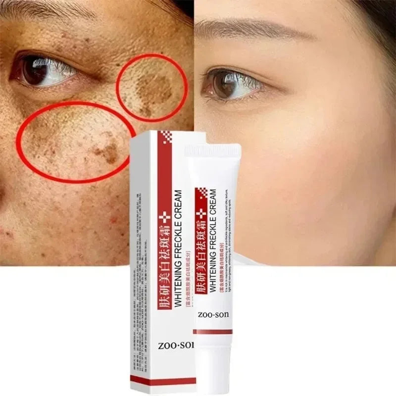 Niacinamide Whitening Freckle Cream – Dark Spot Fader Peaceful Pleasures Health and Wellness Default Title