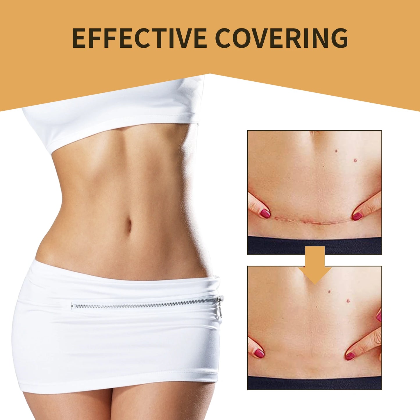 Jaysuing 6-Pack Waterproof Concealer Patches – Tattoo & Skin Cover