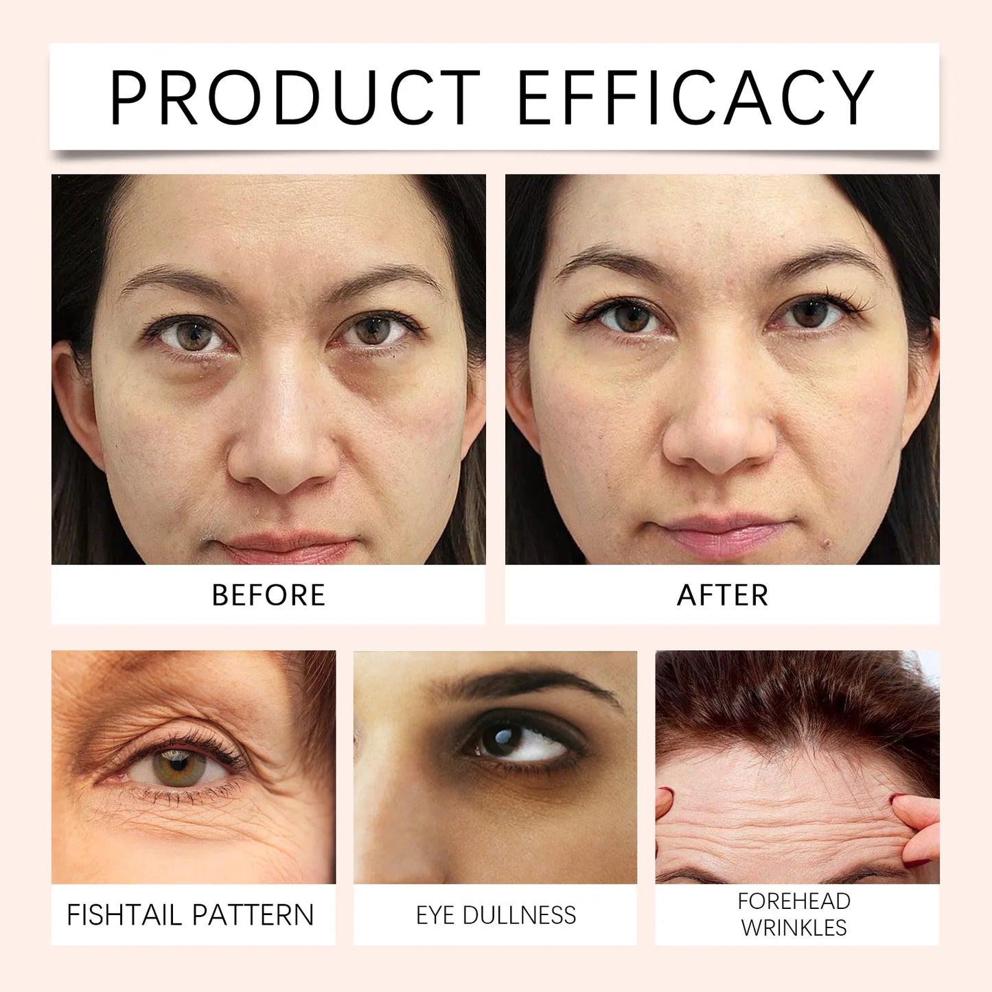 JAYSUING 5-in-1 Under Eye Patches – Hyaluronic Acid & Collagen 60pc