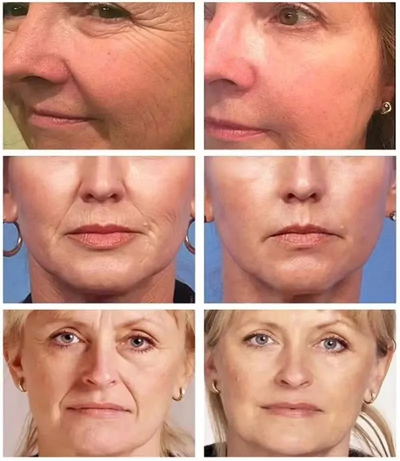 Anti-Aging Face Serum – Firming, Brightening & Fine Line Fader