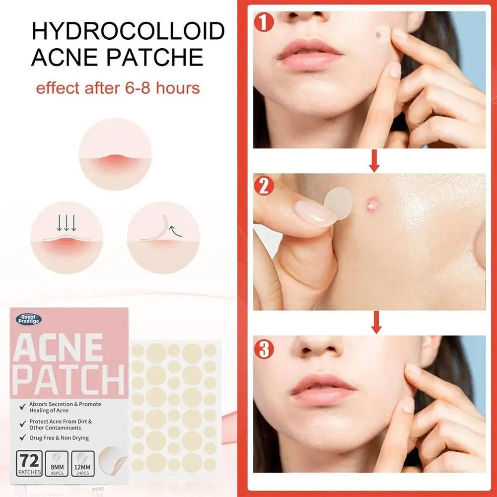 72pcs Invisible Salicylic Acid Acne Patches Anti-Acne Spot Treatment, Waterproof Pimple Concealer, Repair Stickers for Blemish Peaceful Pleasures Health and Wellness