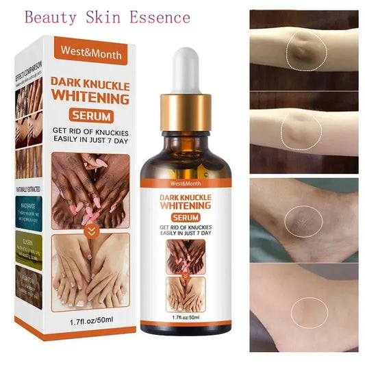 Dark Knuckles Whitening Serum Remover Get Rid of Dark Knees Dark Knuckle Elbow Cream Moisturizing Brighten Skin Tone Care Peaceful Pleasures Health and Wellness