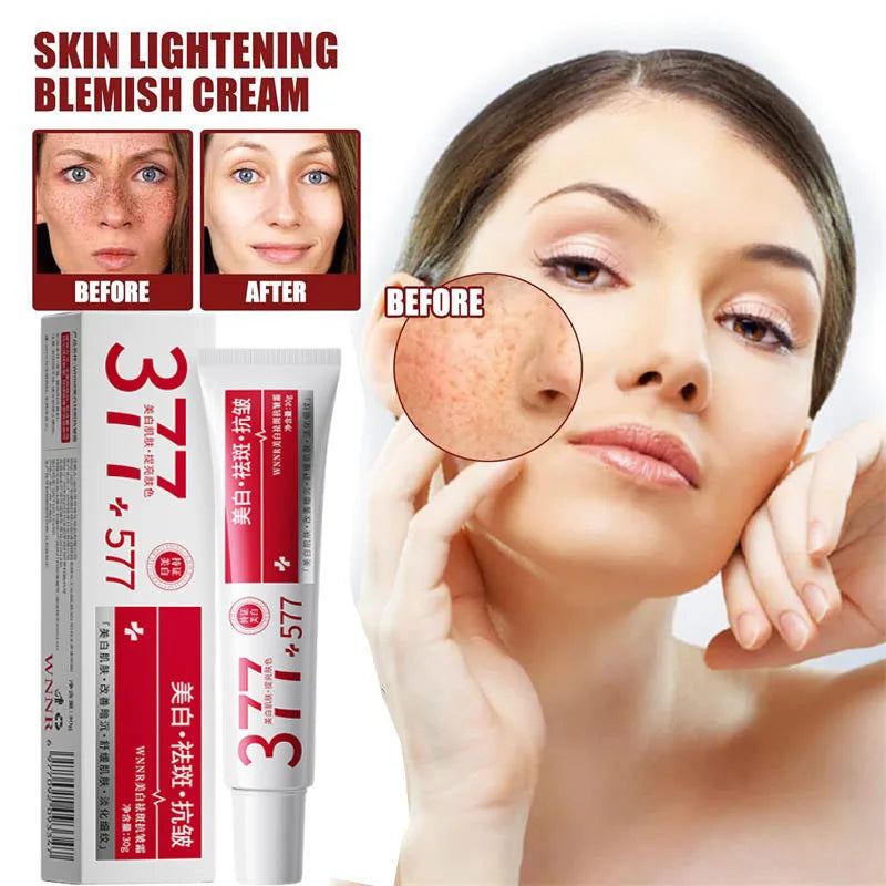 Niacinamide Dark Spot Brightening Cream – Even Skin Tone 30ml