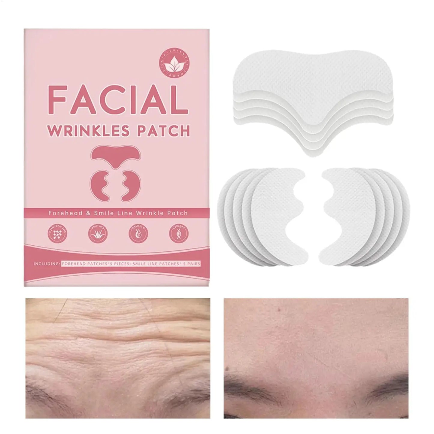 Forehead & Smile Line Lifting Patches – Anti-Wrinkle 10pc Set