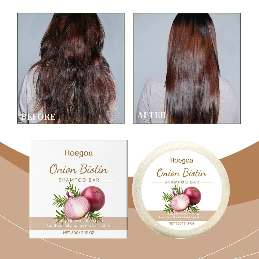 1/2PCS Onion and Biotin Shampoo Soap 60g, Suitable for All Hair Types, Moisturizing and Smoothing, Rich in Rosemary Extract Peaceful Pleasures Health and Wellness