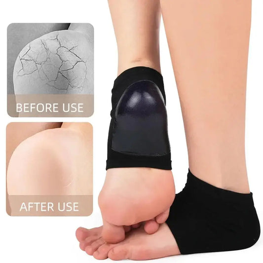 Gel Moisturizing Heel Socks – Dry Cracked Feet Repair 2pk Heel Care Socks Oasis Select