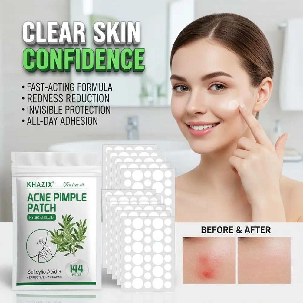 Hydrocolloid Acne Patches – Salicylic Acid & Tea Tree Oil 144pc