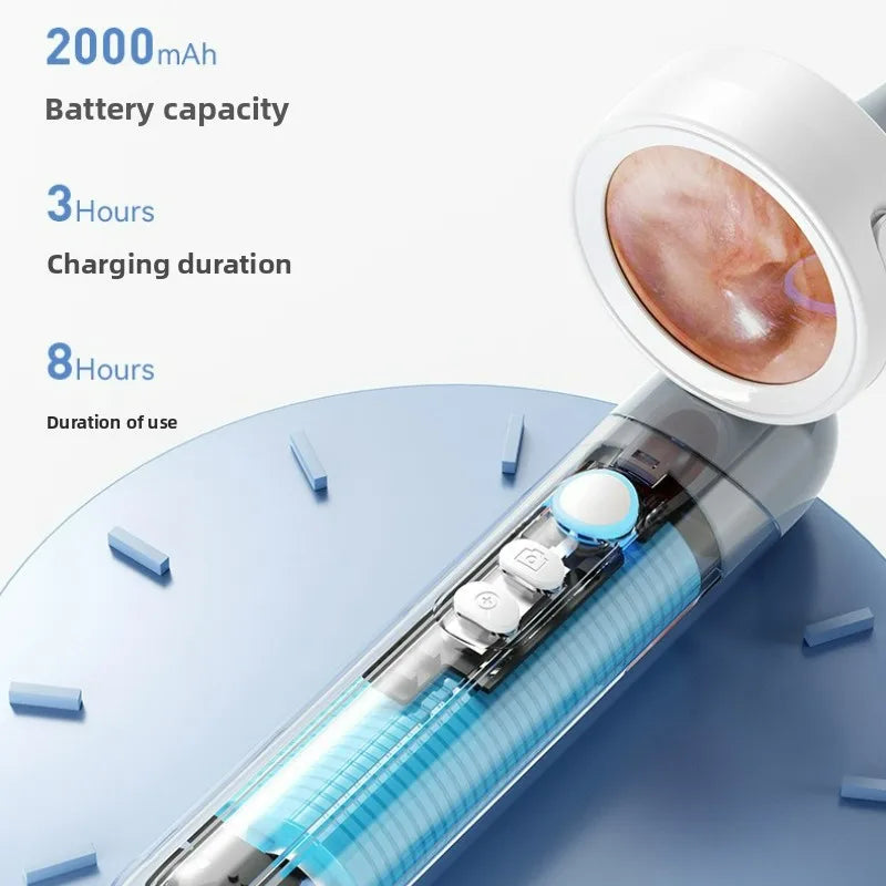 1.38'' Ear Camera Wit IPS Display and 1080P Camera Ear Check Portable Inspector for Ear Mouth Pet With 12tips Replaceable Tools Peaceful Pleasures Health and Wellness