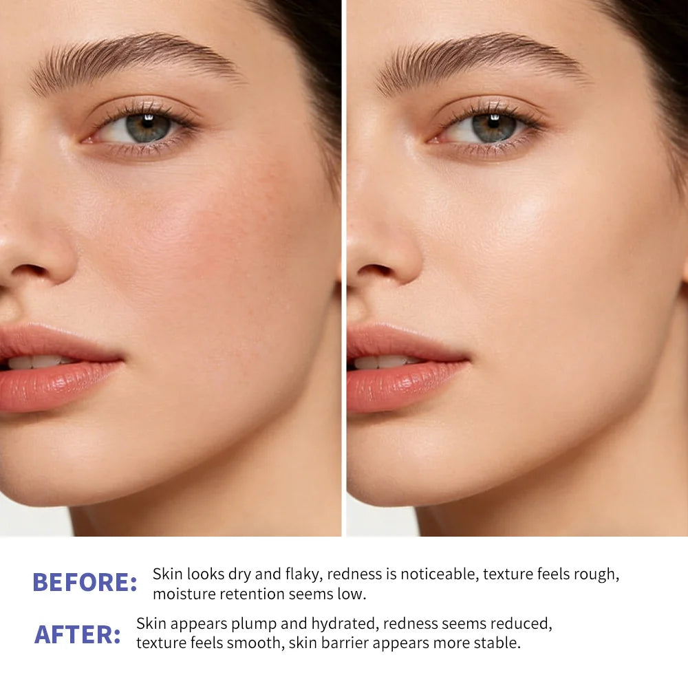 Triple Lipid Peptide Cream Long Lasting Hydration Moisturizer For Dry Normal Sensitive Skin Brighten Skin Care Non-Comedogenic Peaceful Pleasures Health and Wellness