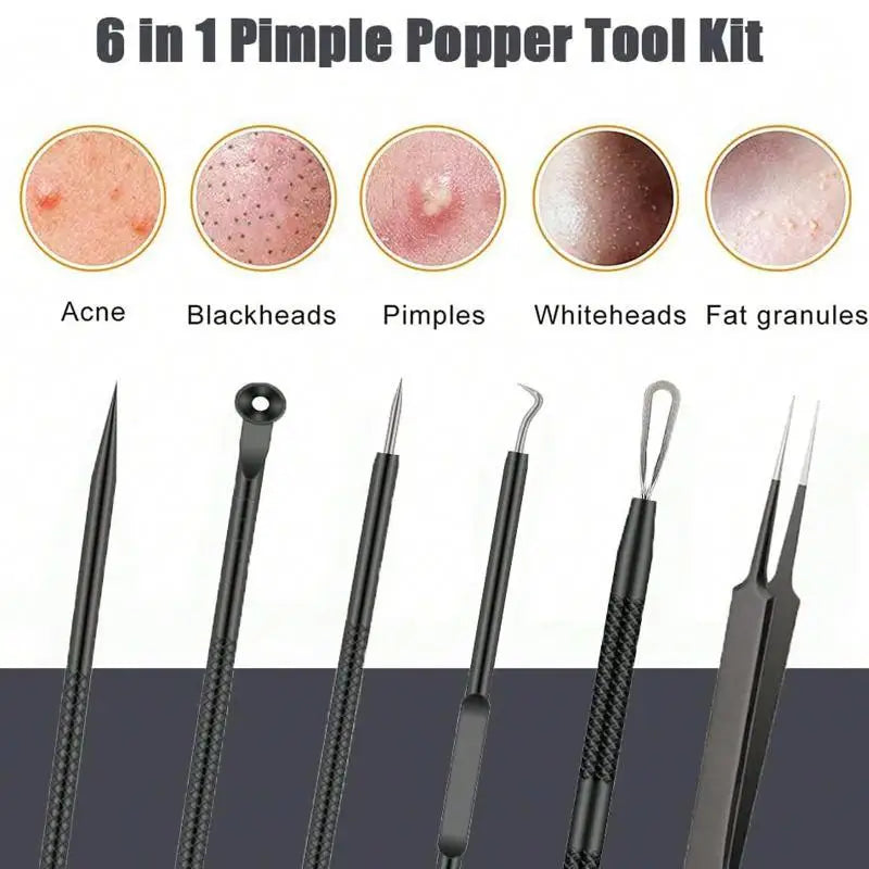 6-Piece Blackhead Comedone Extractor Kit | Home Spa Tool