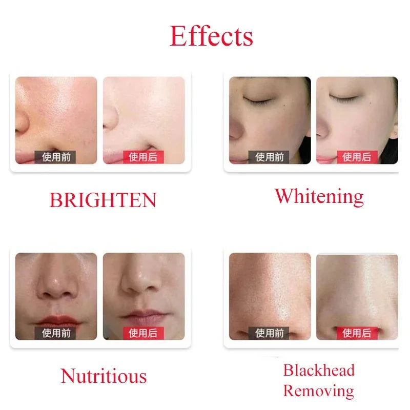 Dermabrasion Facial Serum 50ml | Hydrating Deep Cleansing Exfoliant