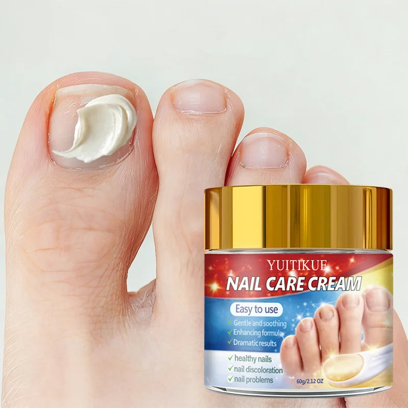 Yuitikue Nail Care Cream, 60g Gentle Nail Repair Cream for Nail Discoloration & Nail Problems, Promoting Healthy Nails Peaceful Pleasures Health and Wellness