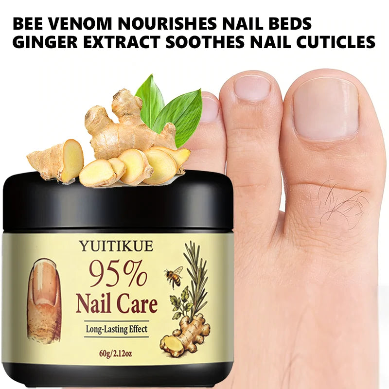 Yuitikue 95% Nail Care Cream, 60g Long-Lasting Nail Repair Cream for Strengthening Nails & Improving Nail Health Peaceful Pleasures Health and Wellness
